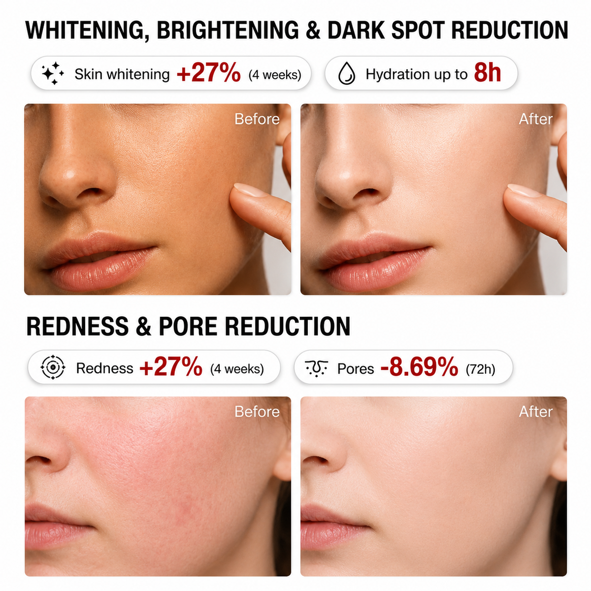 🔥Last Day-Buy 1 Get 1 Free🔥Niacinamide Brightening Essence